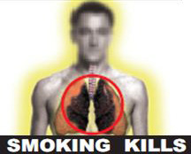 India 2011 Health Effects Lung - Diseased lung 2